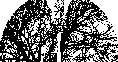 На 12 ноември светът отбелязва 2 международни празника – Международния ден на патологията и Световния ден за борба с пневмонията.